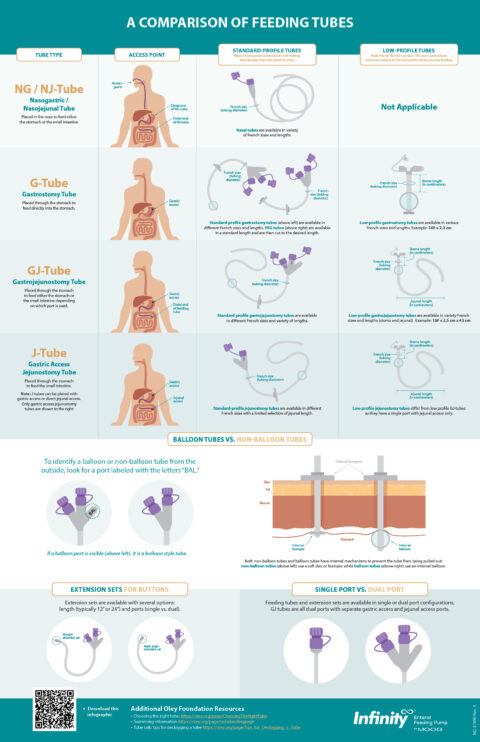 Comparison Of Different Enteral Feeding Tubes And Configurations Moog MD 81890 Rev A Feeding Tube Comparison Infographic 480x742